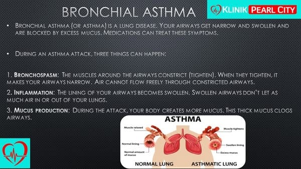 You are currently viewing Struggling to Breathe? Asthma Doesn’t Have to Control You!