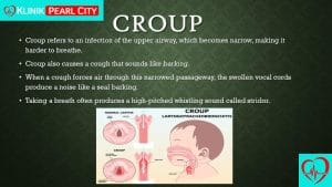 Read more about the article Croup in Kids: What Parents Need to Watch For