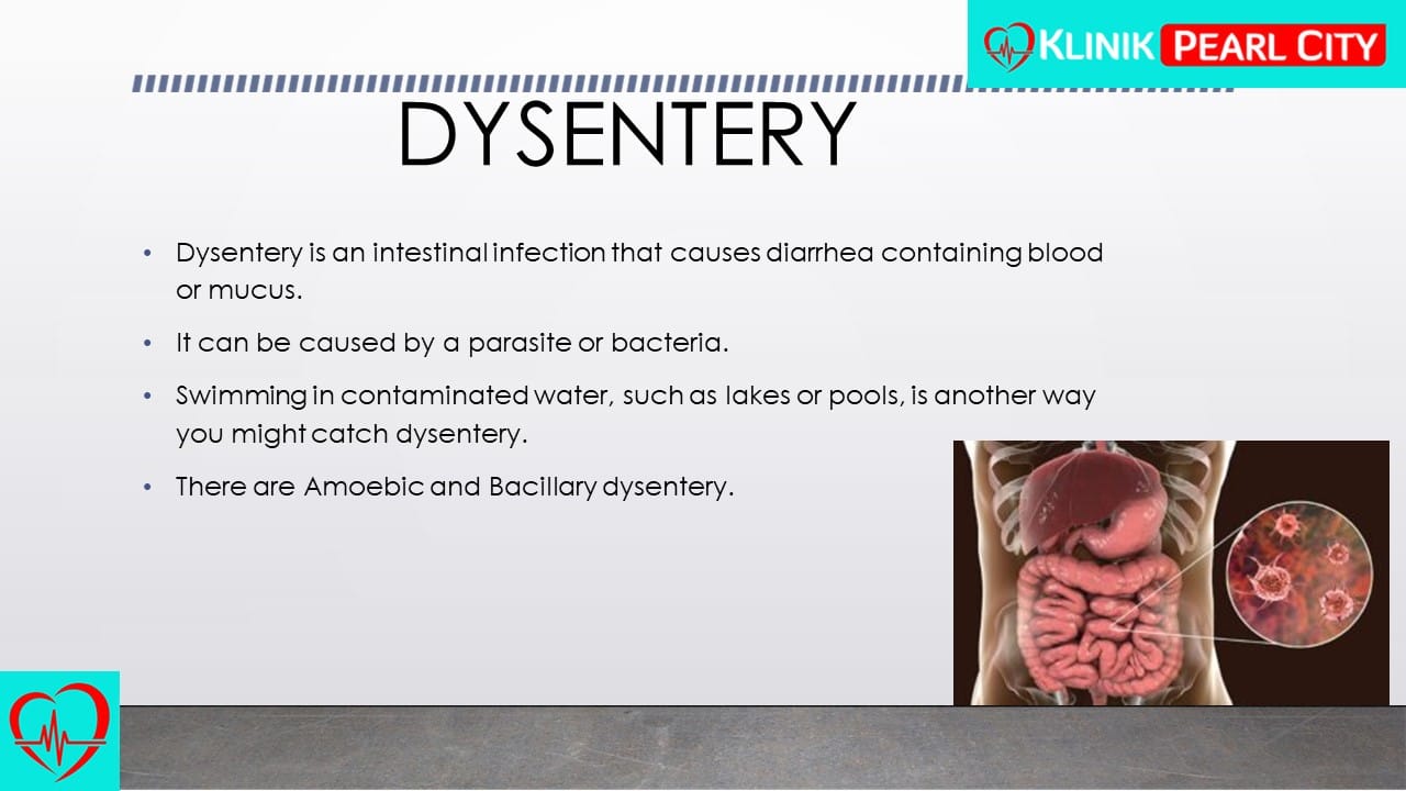 You are currently viewing Severe Stomach Pains & Diarrhea? Don’t Ignore It—It Could Be Dysentery!