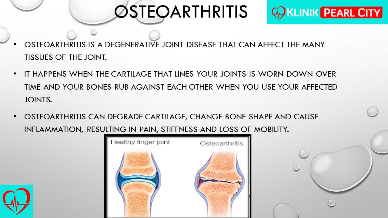 You are currently viewing Did You Know? Your Joints Are Like Shock Absorbers, But They Need Care Too!