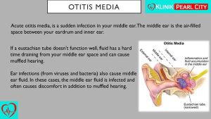 Read more about the article Ear Infection Trouble? Here’s What You Need To Know About Otitis Media!