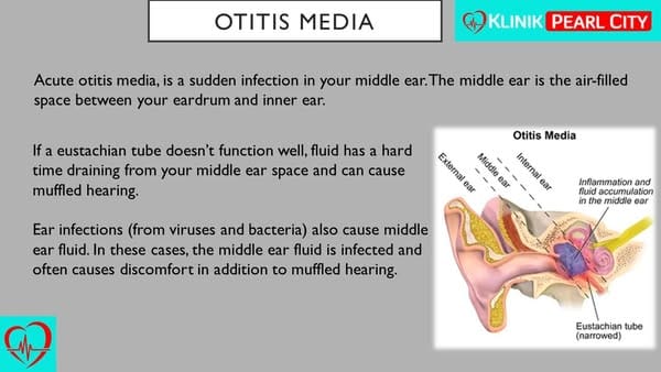 You are currently viewing Ear Infection Trouble? Here’s What You Need To Know About Otitis Media!
